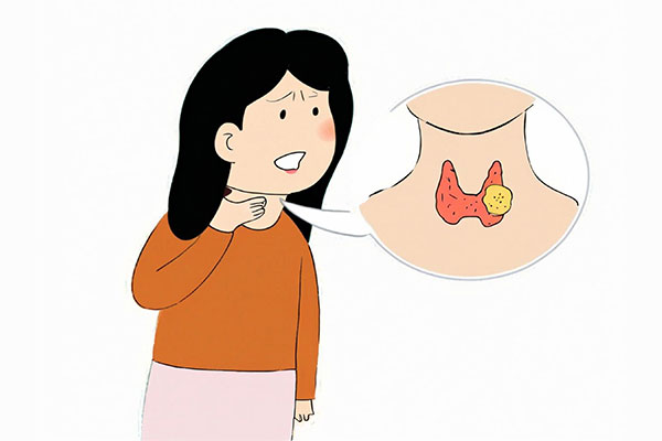 甲状腺结节,易患人群,自我检查,筛查诊断,管理攻略,pg电子官方网站 甲状腺结节,易患人群,自我检查,筛查诊断,管理攻略,pg电子官方网站